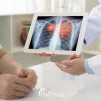 10 Best Lung Cancer Treatment Hospitals in the World